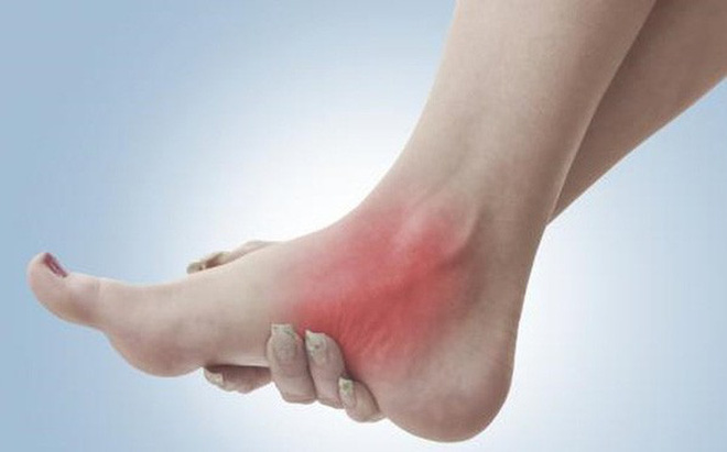 Bong gân - Hình ảnh minh họa